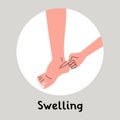 Swelling of the feet, edema. By pressing a finger a dent appers. Flat vector illustration