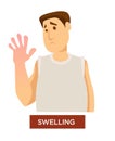 Person experiencing hands swelling and inflammation symptom