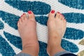 Swollen left foot comparison after wasp sting on female foot Royalty Free Stock Photo