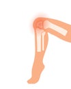 Symbol of knee joint bones