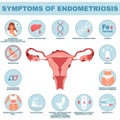 Symptom of endometriosis reproductive disease vector illustration