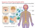 Symptoms of Acute Flaccid Myelitis or AFM