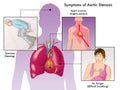 Symptoms of aortic stenosis