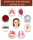 Symptoms and diseases caused by SLE, info graphic illustration on white background