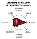 Symptoms of infection are the hepatic trematode Royalty Free Stock Photo