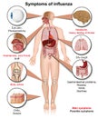 Symptoms of influenza 3d medical illustration on white background isolated infographic