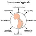 Symptoms of kyphosis. Spinal curvature, kyphosis, lordosis, scoliosis, arthrosis. Improper posture and stoop