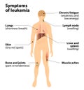 Symptoms of leukemia. blood cancer