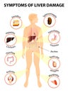 Symptoms Of Liver Disease