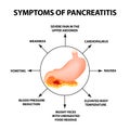 Symptoms of pancreatitis. The structure of the stomach and pancreas. Infographics. Vector illustration on isolated Royalty Free Stock Photo