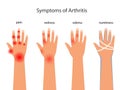 Symptoms of rheumatoid arthritis, redness, edema, numbness. Pain in the hands with autoimmune disease vector poster