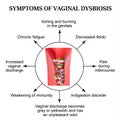 Symptoms of vaginal dysbiosis. Vaginitis, candidiasis. Patagene microflora of the vagina. Dysbacteriosis. Infographics.