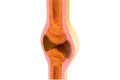 Synovial joint anatomy Royalty Free Stock Photo