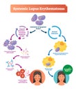 Systemic lupus erythematosus labeled diagram with normal and sick patient. Royalty Free Stock Photo