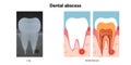 Clear, minimal medical diagram showing the basic anatomy of tooth Royalty Free Stock Photo