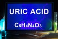 Tablet with chemical formula of uric acid.