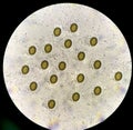 Taenia eggs in stool find with microscope