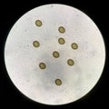 Taenia eggs in stool find with microscope