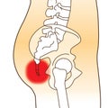 Tailbone pain red spot area, illustration Royalty Free Stock Photo