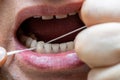Oral hygiene, cleaning teeth with dental floss
