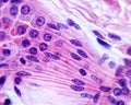 Apocrine sweat gland. Myoepithelial cells Royalty Free Stock Photo