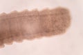 Tapeworms (Cestoda: Caryophyllidea), Parasites of Fish under the microscope for education Royalty Free Stock Photo