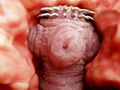 Tapeworm head attached to the intestine