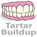 Tartar Buildup on Teeth Royalty Free Stock Photo