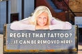 Tattoo removal - Hobart