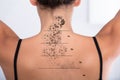 Tattoo Removal On Woman`s Back