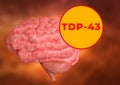 TDP-43, TAR DNA binding protein 43, is a biochemical marker of neurodegenerative diseases