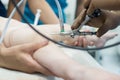 A team of urologist doctors performing a cystoscopy using a cystoscope. In a sterile operating room. close-up