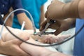 A team of urologist doctors performing a cystoscopy using a cystoscope. In a sterile operating room. close-up