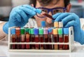 Technician holding a blood sample tube for analysis in the lab