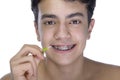 Teen boy wearing braces on white background Royalty Free Stock Photo