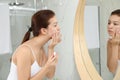 Teen girl with acne problem applying cream near mirror Royalty Free Stock Photo