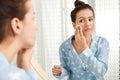 Teen girl with acne problem cleaning her face near mirror Royalty Free Stock Photo