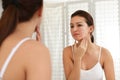 Teen girl with acne problem near mirror Royalty Free Stock Photo