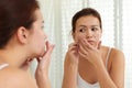 Teen girl with acne problem squeezing pimple near mirror