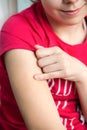 Teen girl showing mark of the tuberculosis vaccine BCG on the shoulder, close up view Royalty Free Stock Photo