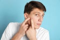 Teen guy with acne problem squeezing pimple on blue background