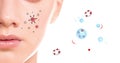 Teenage acne. Close-up of a woman`s face, animated cartoon pimples