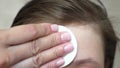 Teenage girls apply a moisturizing face cream for acne. girl rubs her forehead with a napkin. Cosmetic procedures for