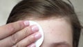 Teenage girls apply a moisturizing face cream for acne. girl rubs her forehead with a napkin. Cosmetic procedures for