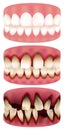 teeth Royalty Free Stock Photo