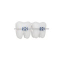Teeth braces 3D render icon