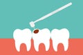 Teeth cartoon vector. dental equipment vector. Tooth cavity