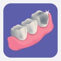 teeth with cavity. Vector illustration decorative design Royalty Free Stock Photo