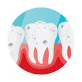 teeth cavity. Vector illustration decorative design Royalty Free Stock Photo
