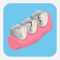 teeth with crack. Vector illustration decorative design